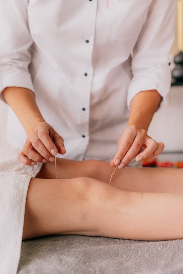 Acupuncture pour lutter contre l'addiction au sucre